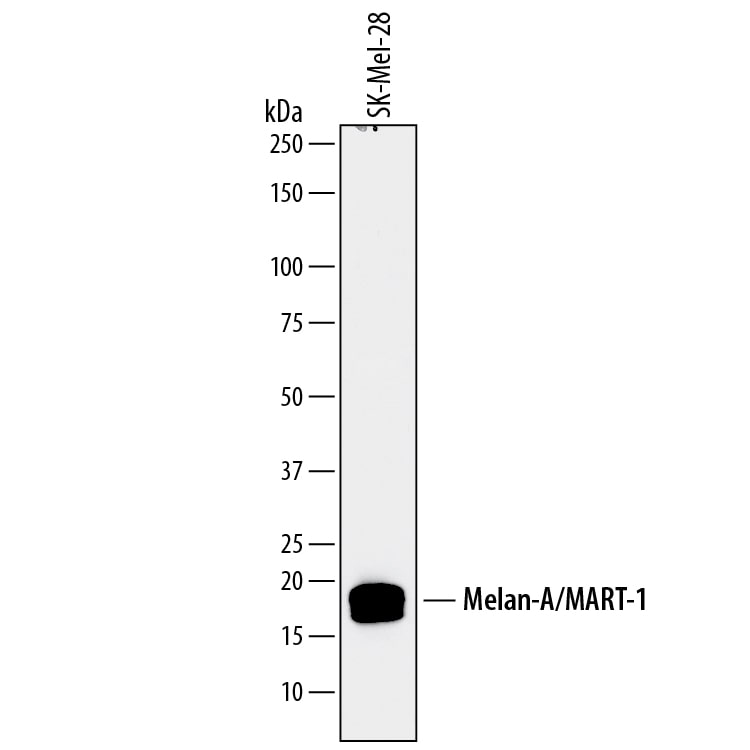 Detection of Human Melan-A/MART-1 antibody by Western Blot.