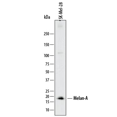 Detection of Human Melan-A/MART-1 antibody by Western Blot.
