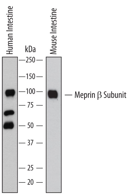 Detection of Human and Mouse Meprin  beta  Subunit/ MEP1B antibody by Western Blot.