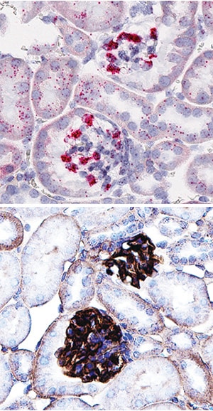 Mer antibody in Mouse Kidney Using Dual RNAscope®ISH and IHC.