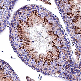 Mer antibody in Mouse Testis by Immunohistochemistry (IHC-Fr).