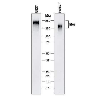 Detection of Human Mer antibody by Western Blot.