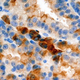 Midkine antibody in Human Prostate by Immunohistochemistry (IHC-P).