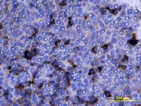 Midkine antibody in Human Ovarian Array by Immunohistochemistry (IHC-P).