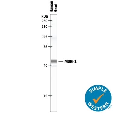 Detection of Human MuRF1/TRIM63 antibody by Simple WesternTM.