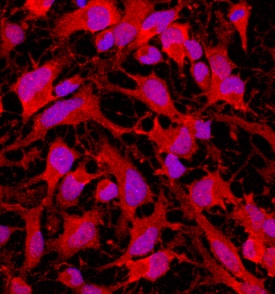 Musashi-2 antibody in Rat Cortical Stem Cells by Immunocytochemistry (ICC).
