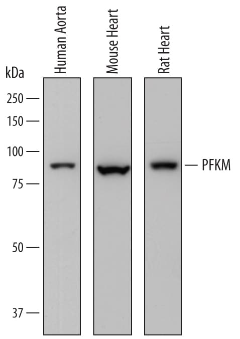 Detection of Human, Mouse, and Rat Muscle Phosphofructokinase/PFKM antibody by Western Blot.
