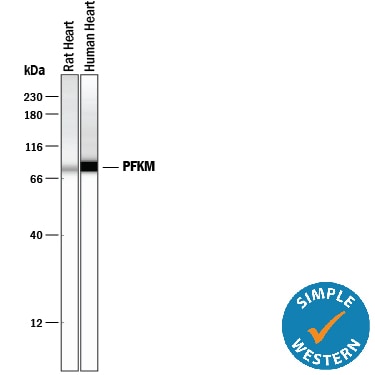 Detection of Human and Rat Muscle Phosphofructokinase/PFKM antibody by Simple WesternTM.