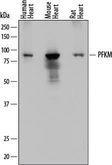 Detection of Human, Mouse, and Rat Muscle Phosphofructokinase/PFKM antibody by Western Blot.