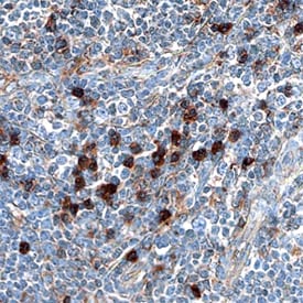 MxA/Mx1 antibody in Human Thymus by Immunohistochemistry (IHC-P).