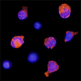 MxA/Mx1 antibody in Human PBMCs by Immunocytochemistry (ICC).