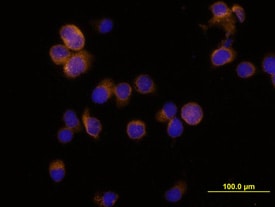 Myeloperoxidase/MPO antibody in HL-60 Human Cell Line by Immunocytochemistry (ICC).