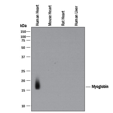 Detection of Human Myoglobin antibody by Western Blot.