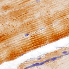 Myosin Heavy Chain antibody in Human Skeletal Muscle by Immunohistochemistry (IHC-P).