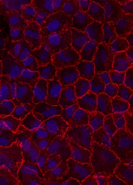 N-Cadherin antibody in A549 Human Cell Line by Immunocytochemistry (ICC).