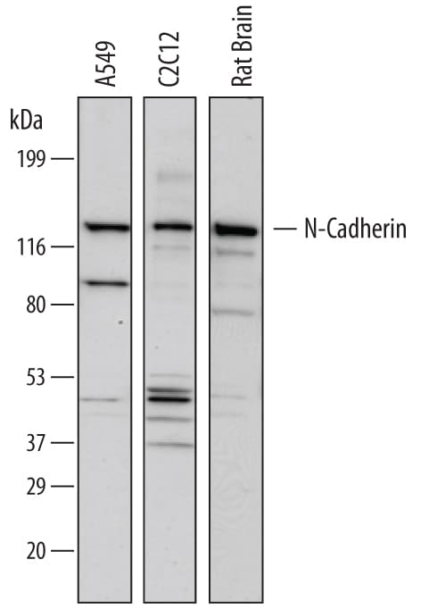 Detection of Human, Mouse, and Rat N‑Cadherin antibody by Western Blot.