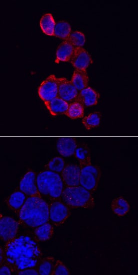 NLRP3/NALP3 antibody in THP-1 Human Cell Line by Immunocytochemistry (ICC).
