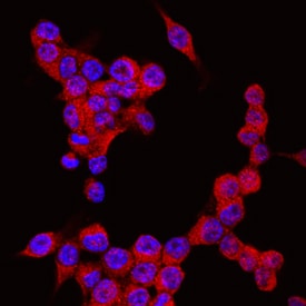 NLRP3/NALP3 antibody in RAW 264 by Immunocytochemistry (ICC).7 Mouse Cell Line by Immunocytochemistry (ICC).