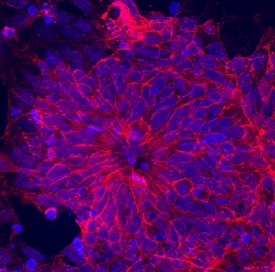 NCAM-1/CD56 antibody in BG01V Human Embryonic Stem Cells by Immunocytochemistry (ICC).