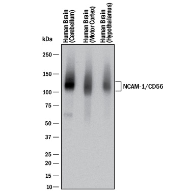 Detection of Human NCAM-1/CD56 antibody by Western Blot.