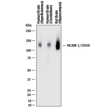 Detection of Human and Rat NCAM-1/CD56 antibody by Western Blot.