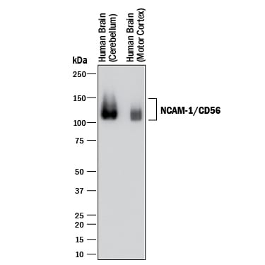 Detection of Human NCAM-1/CD56 antibody by Western Blot.
