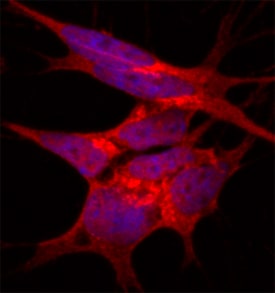 NDFIP1 antibody in SH-SY5Y Human Cell Line by Immunocytochemistry (ICC).