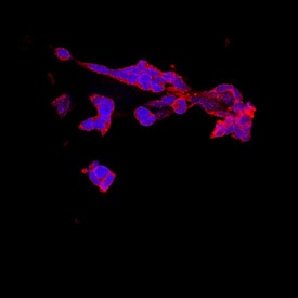 NELL1 antibody in IMR32 Human Cell Line by Immunocytochemistry (ICC).