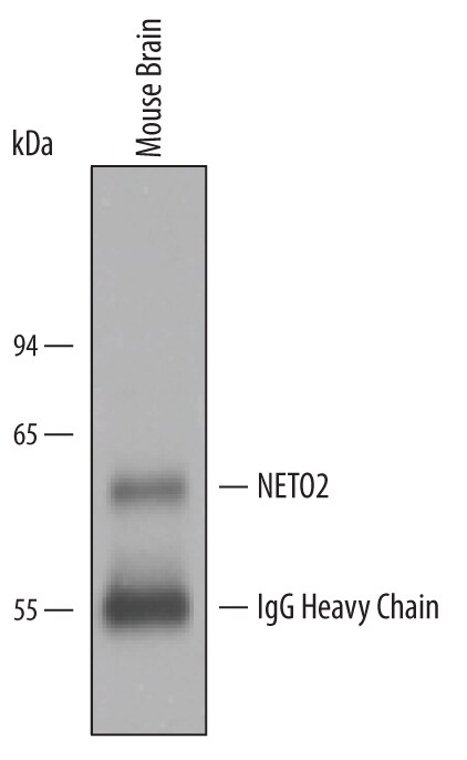 Immunoprecipitation of Mouse NETO2.