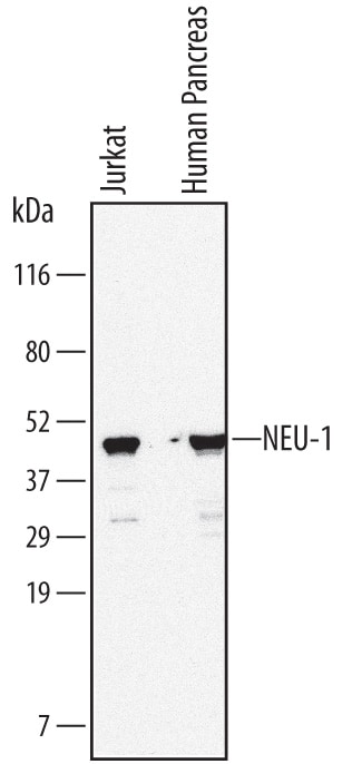 Detection of Human NEU‑1/Sialidase‑1 antibody by Western Blot.