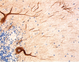 NF-H antibody in Human Brain by Immunohistochemistry (IHC-P).