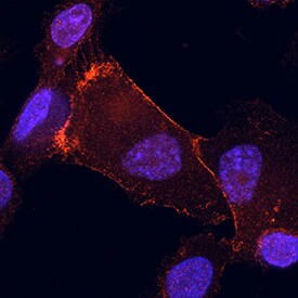 NF2/Merlin antibody in SK-HEP-1 Human Cell Line by Immunocytochemistry (ICC).