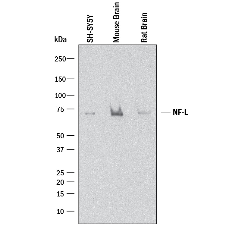 Detection of Human, Mouse, and Rat NF-L antibody by Western Blot.