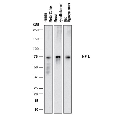 Detection of Human, Mouse, and Rat NF-L antibody by Western Blot.