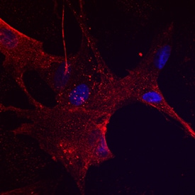 NGF R/TNFRSF16 antibody in Canine Mesenchymal Stem Cells by Immunocytochemistry (ICC).