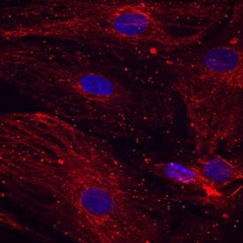 NGF R/TNFRSF16 antibody in Human Mesenchymal Stem Cells by Immunocytochemistry (ICC).
