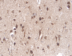 NGF R/TNFRSF16 antibody in Human Brain by Immunohistochemistry (IHC-P).