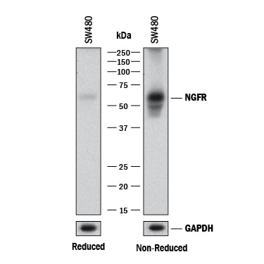 Detection of Human NGF R/TNFRSF16 antibody by Western Blot.