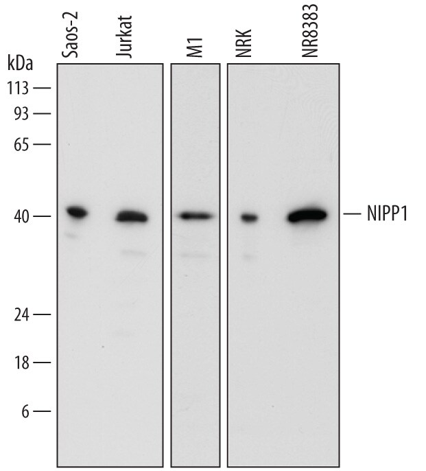 Detection of Human, Mouse, and Rat NIPP1 antibody by Western Blot.