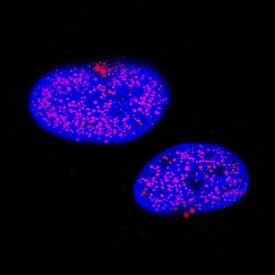 TTF-1/NKX2-1 antibody in A549 Human Cell Line by Immunocytochemistry (ICC).