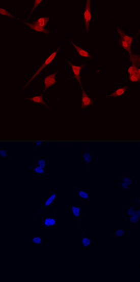 NKX3 by Immunocytochemistry (ICC).1 antibody in LNCaP Human Cell Line by Immunocytochemistry (ICC).