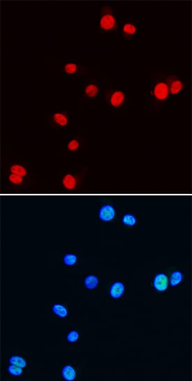 NKX3 by Immunocytochemistry (ICC).1 antibody in NIH-3T3 Mouse Cell Line by Immunocytochemistry (ICC).