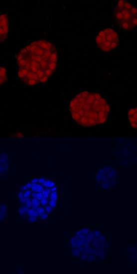 NKX6 by Immunocytochemistry (ICC).1 antibody in  beta TC-6 Mouse Cell Line by Immunocytochemistry (ICC).