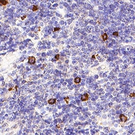 NKp46/NCR1 antibody in Human Tonsil by Immunohistochemistry (IHC-P).