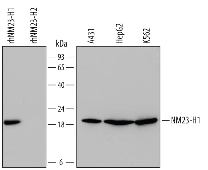 Detection of Human NM23-H1 antibody by Western Blot.