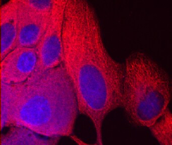 NM23-H1/H2 antibody in MCF-7 Human Cell Line by Immunocytochemistry (ICC).