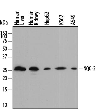 Detection of Human NQO-2 antibody by Western Blot.