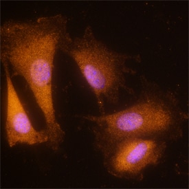 NRAGE antibody in C2C12 Mouse Cell Line by Immunocytochemistry (ICC).