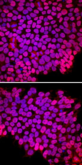 Nanog antibody in ADLF1 and FAB2 Stem Cell Lines by Immunocytochemistry (ICC).