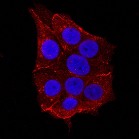 Nectin-2/CD112 antibody in MCF-7 Human Cell Line by Immunocytochemistry (ICC).